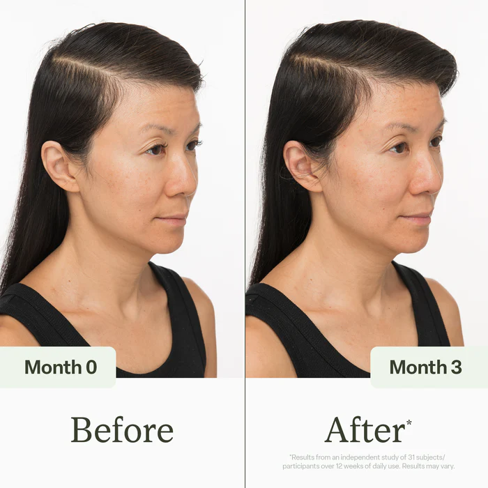 30ml Scalp Serum